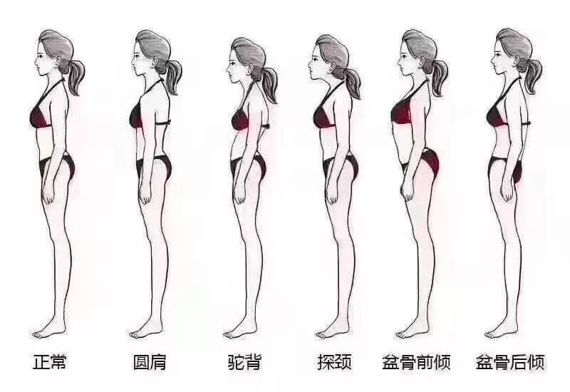 健身房私教矫正体态_体态矫正健身房好还是瑜伽_体态矫正私教多少钱